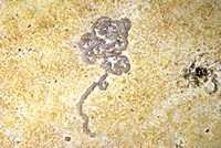 Lumbricaria (coprolithes) 